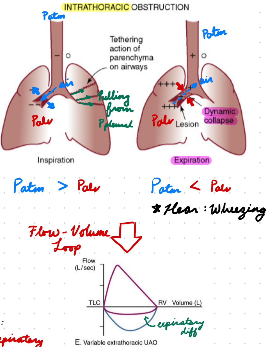 <p>Muscle contraction expands lungs = Open obstructed airway</p>