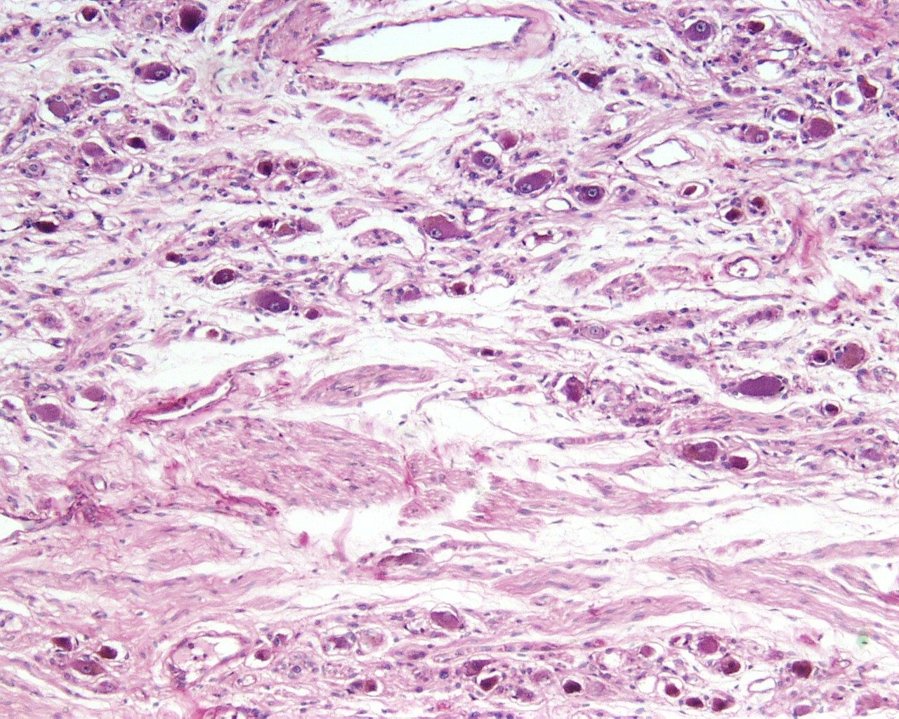 <p>Identifica la plaquita</p>