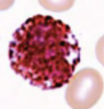 <p>name the leukocyte</p>