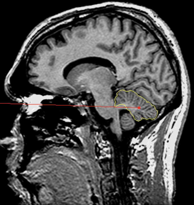 <p>What is the area highlighted called?</p>
