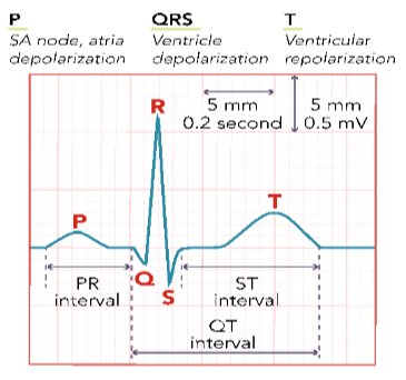 <p>PR interval</p>