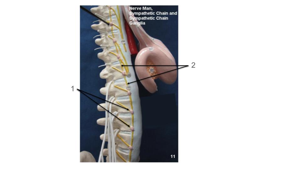 <p>1, structure</p>
