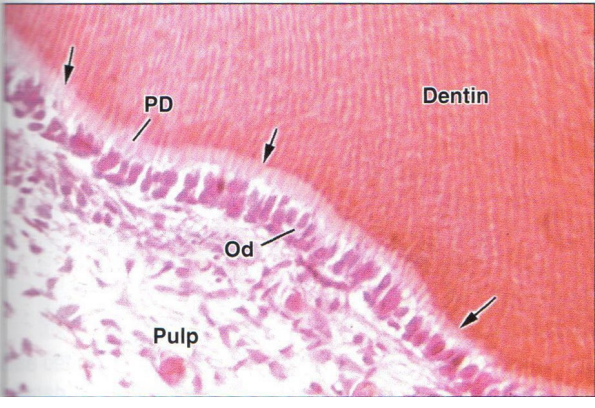 <p>more uniform mineralization front</p><p>slow dentin despotiton rate</p><p>only on circumpulpal dentin</p>