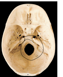 <p>Name this bone</p>