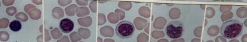 <p>What white blood cell is this</p>