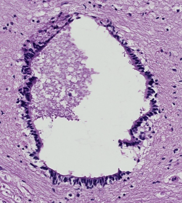 <ol><li><p>what do we call the fluid filled space within the spinal cord?</p></li><li><p>which glial cells line this space?</p></li><li><p>do these cells manufacture cerebrospinal fluid?</p></li></ol><p></p>
