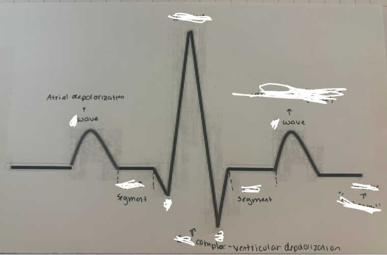 <p>EKG Diagram</p>