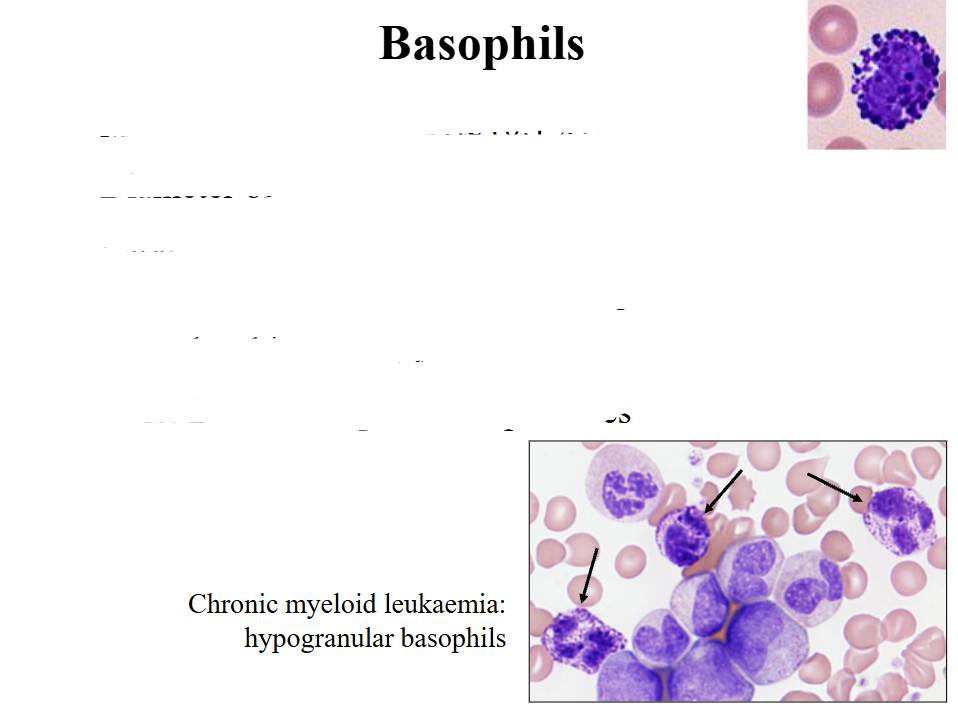 <p>- Most infrequent leucocyte (0.1 x109/L)</p><p>- Diameter of about 12 micrometres</p><p>- Large round purple-black cytoplasmic granules that overlie nucleus; nucleus has two segments</p><p>- Granules: histamine; tryptase</p><p>- Role: immune responses to parasites</p><p>.</p><p>- we use basophils in another way to make diagnosis of chronic myeloid leukaemia. the pointed basophils dont look like normal ones (top right of slide) because they are hypogranular and now we can see the nucleus</p>