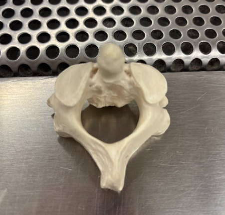 <p>What is this bone?</p>