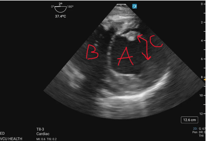 <p>What is at C? </p>