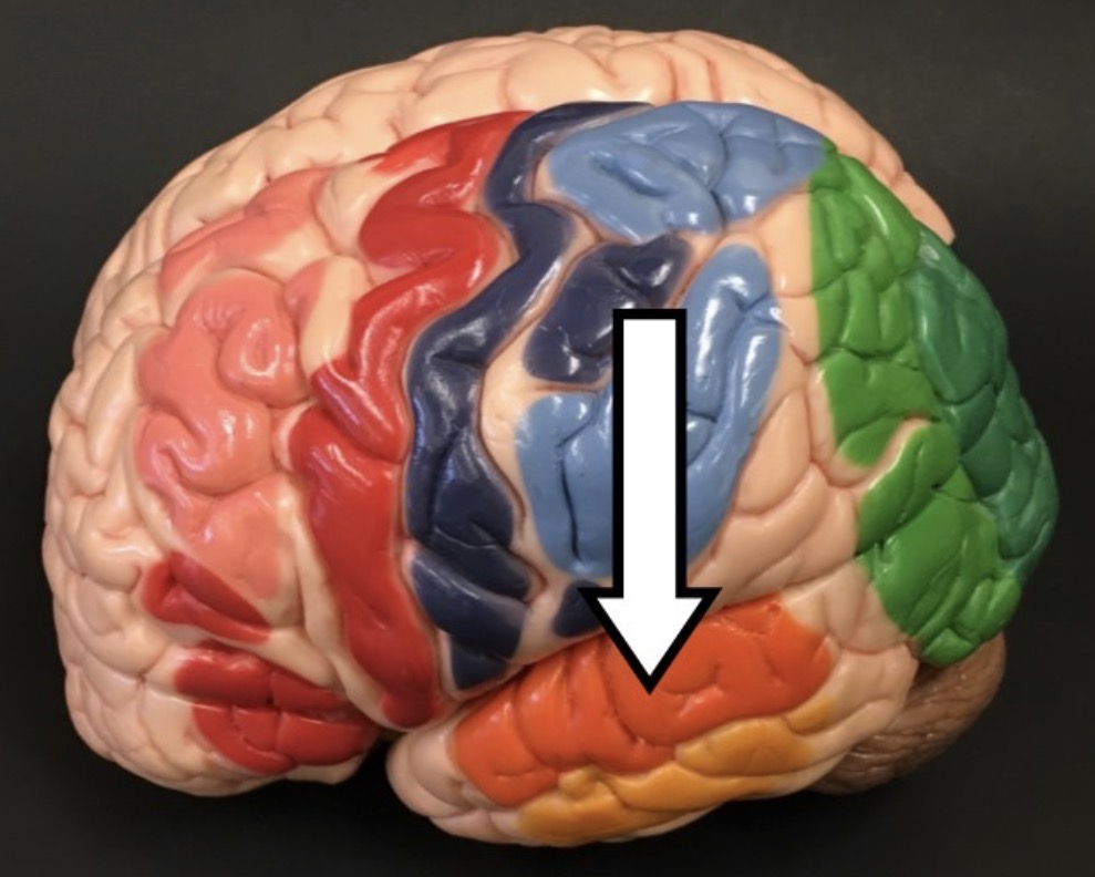 <p>What lobe is the arrow pointing to?</p>
