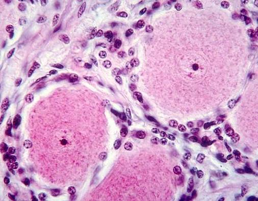 <p>spinal ganglia</p>
