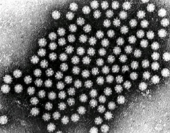 <p>Describe the <strong>Source </strong>of this waterborne virus:</p><p>-<strong>Astrovirus</strong></p>