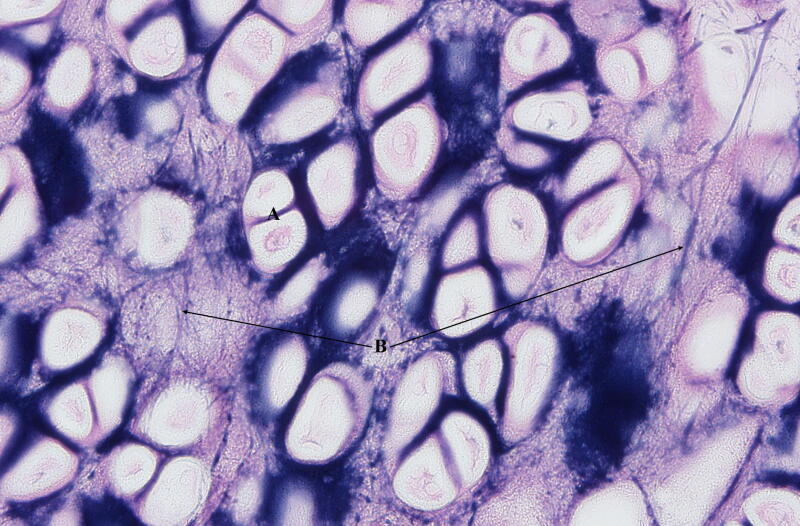 <p>fxn: maintains shape of a structure while allowing flexibility, found external ear (pinna); epiglottis</p>
