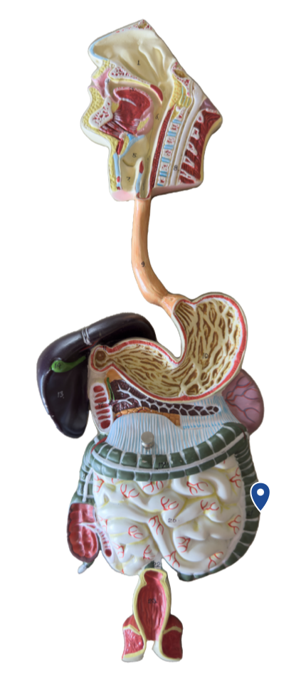 <p>Name this segment of the large intestine.</p>