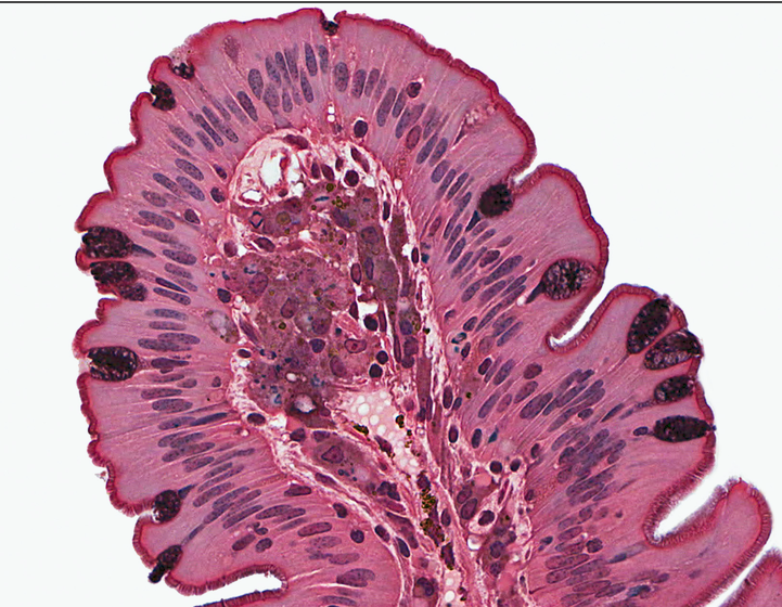 <p>what tissue type is this</p>
