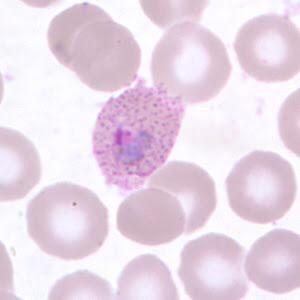 <p>Schuffners dots in young RBCS?</p>
