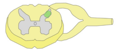 <p>đź’ˇsubstantia gelitonsa resides in Rexed laminae II & III in the dorsal horn </p><p>đź’ˇyour right = the screen's left bc mirrors it lol</p>