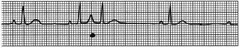 <p>Which rhythm is this?</p>