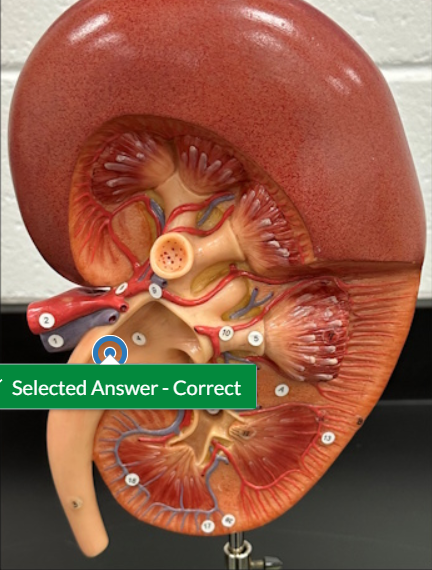 <p>What is the selected structure?</p>