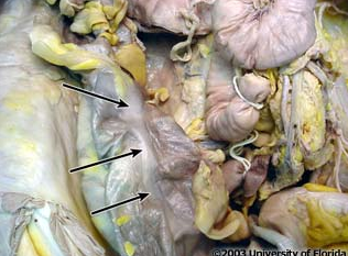 <p>what structure on the large intestine is this (be specfic)?</p>