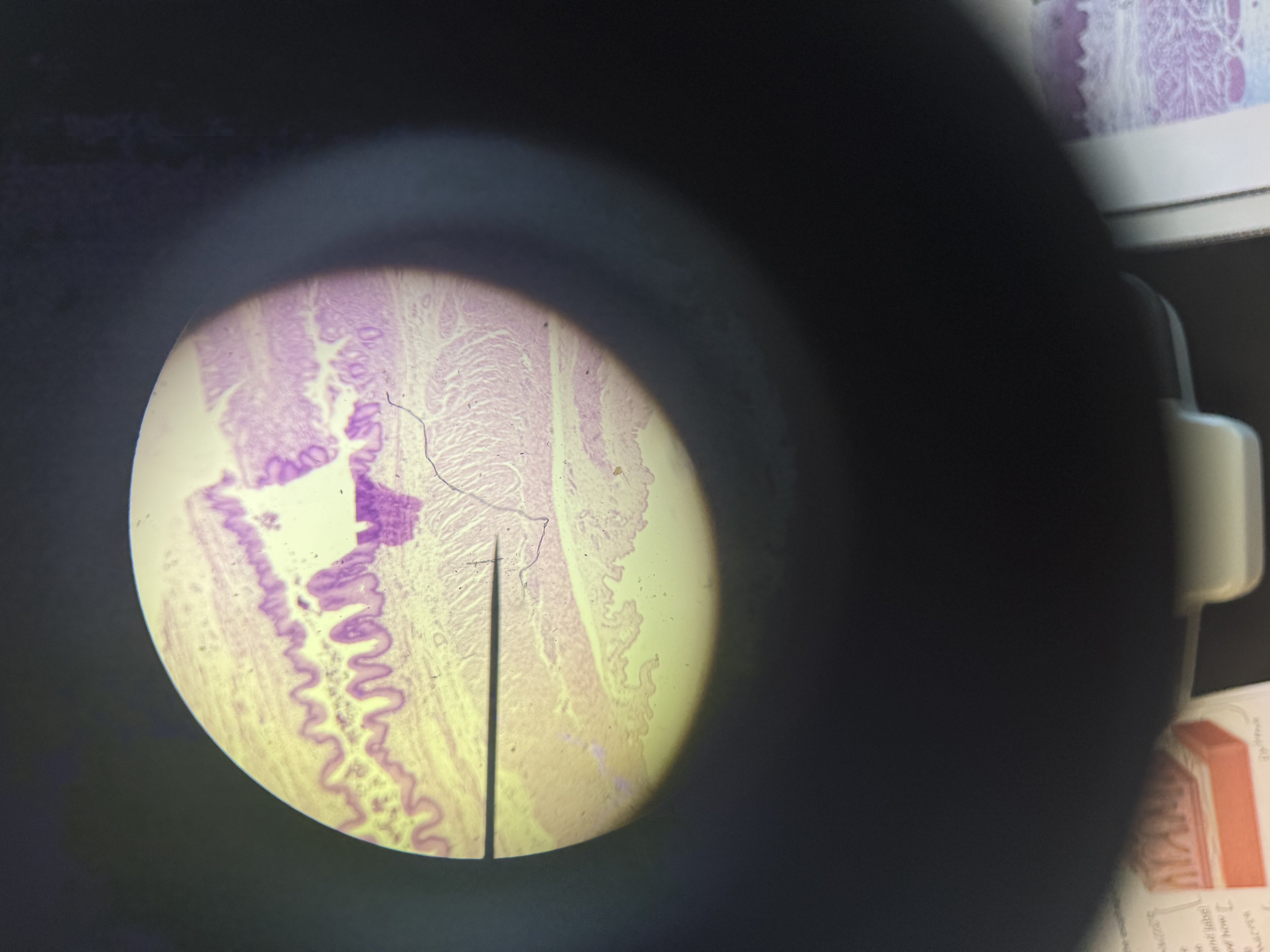 <p>esophagus histology</p>