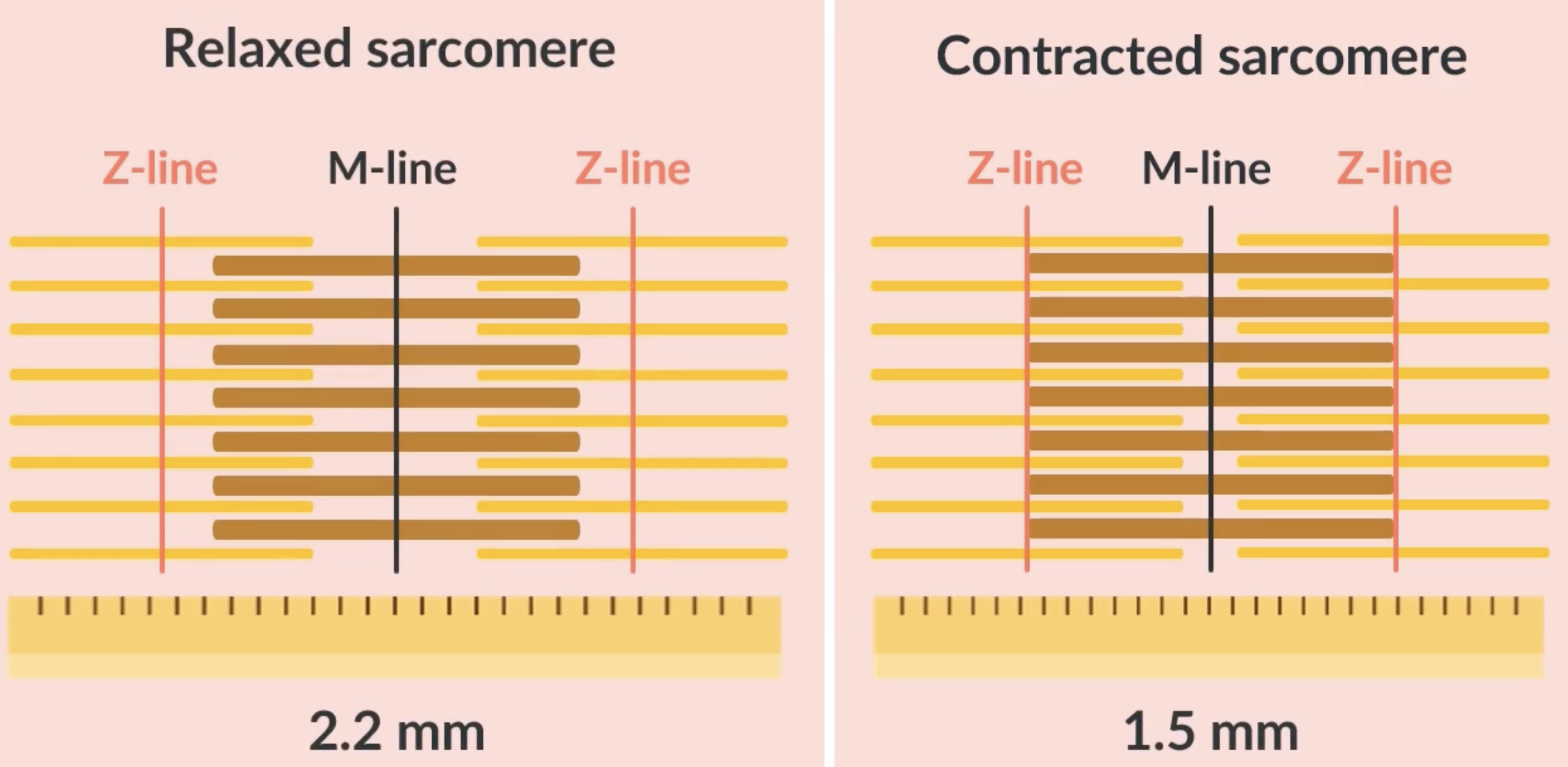 <p>during contraction, the actin filaments slide along the myosin filaments, more of the actin and myosin filaments overlap, causing a darker section of the sarcomere </p><p>during contraction:</p><p>-length of the sarcomere shortens </p><p>-Z lines move more closely together </p><p>-I band becomes narrower  </p><p>-A band stays the same </p><p>-H zone becomes narrower  </p>