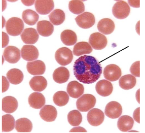 <p><span style="line-height: 17.375px;">Identify the blood cell shown here.&nbsp;</span></p>