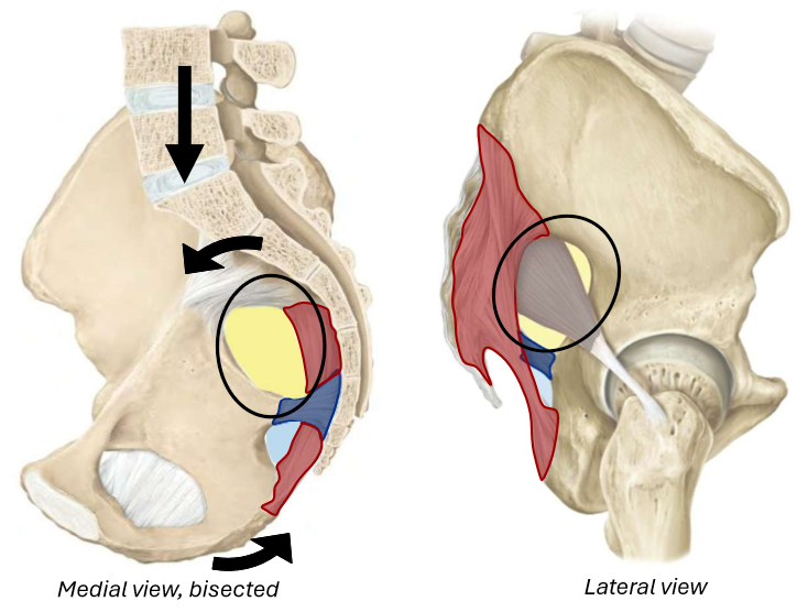 term image
