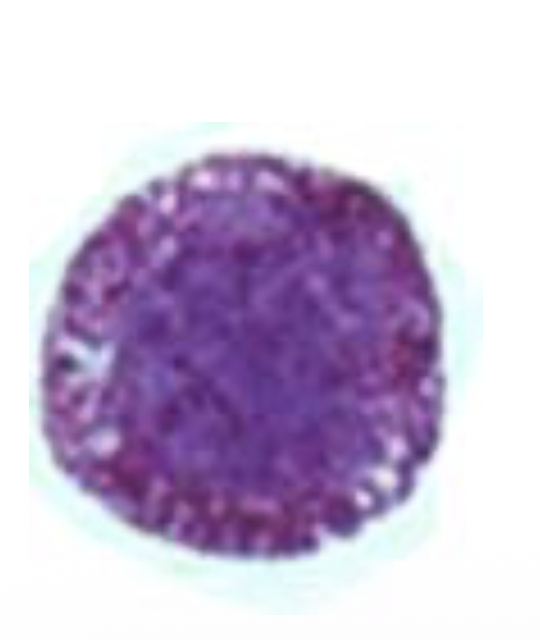 <p><strong>1 of the 6 Cells of the Innate Immune System:</strong></p><ul><li><p><u>Function</u><span style="background-color: transparent;">:</span></p><ul><li><p>Histamine release lead to:</p><ul><li><p>Increase in vascular permeability </p></li><li><p>Smooth muscle contraction </p></li></ul></li><li><p>IL-4 and IL-13 release lead to:</p><ul><li><p>Th2 lymphocyte differentiation </p></li><li><p>IgE production </p></li></ul></li></ul></li><li><p><u>Clinical Significance</u>:</p><ul><li><p>Dark cytoplasm filled with granulesNumbers increase during allergic reactions </p></li></ul></li></ul><p></p>