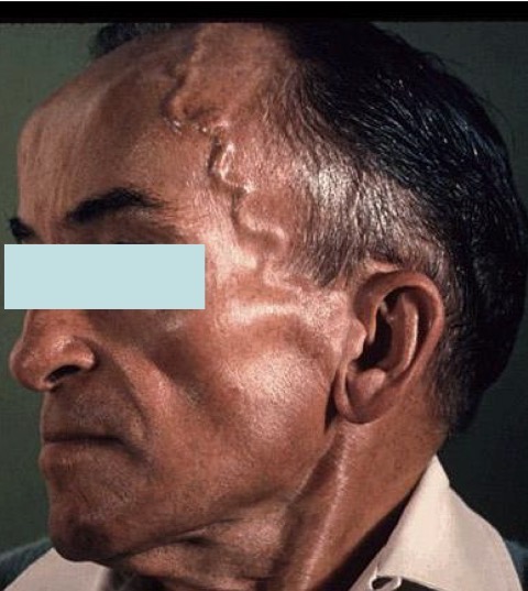 term image