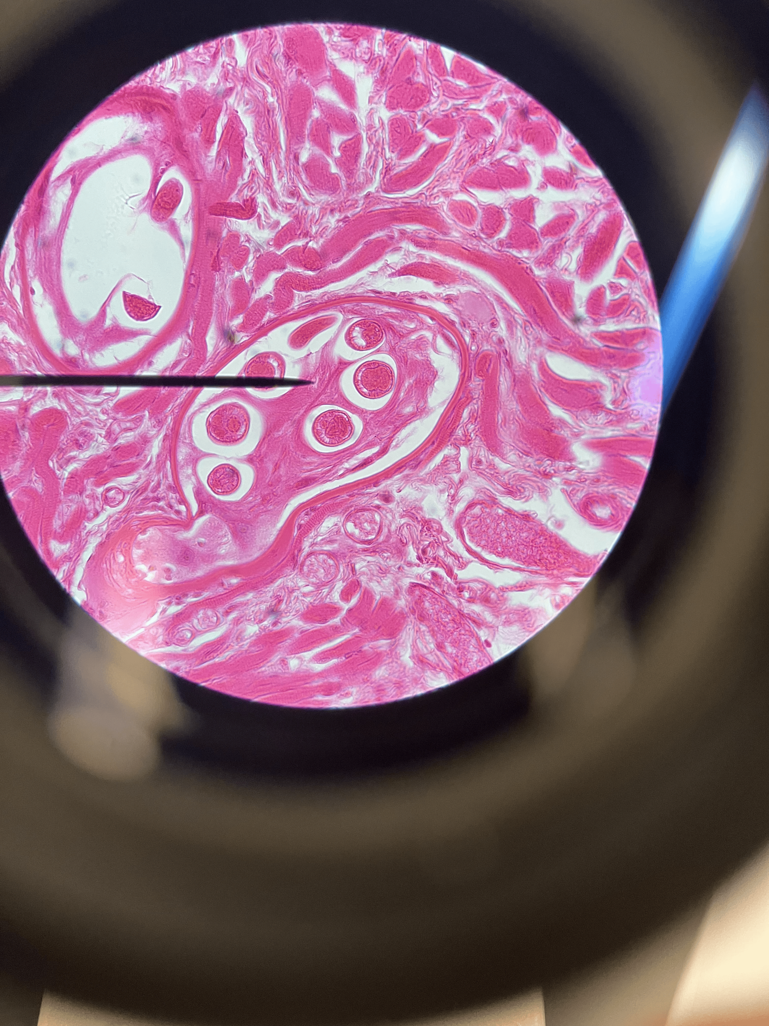<ul><li><p>kingdom: <strong>animalia</strong></p></li><li><p>cell type: <strong>eukaryotic</strong></p></li><li><p>In <strong>skeletal muscle</strong> fibers</p></li><li><p><strong>roundworm</strong></p></li><li><p> <strong>trichinosis</strong> —> can get from undercooked pork</p></li><li><p><strong>cysts</strong> form where worm lives</p></li><li><p><em>400x</em></p></li></ul><p></p>