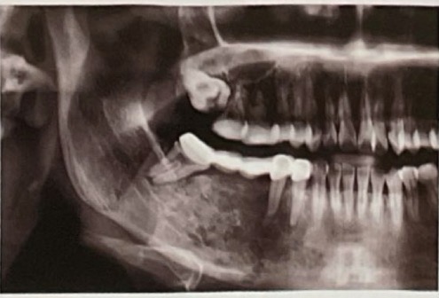 <p>CHẨN ĐOÁN?</p>