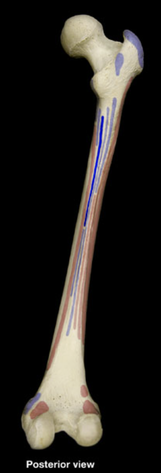 <p>linea aspera of femur</p>