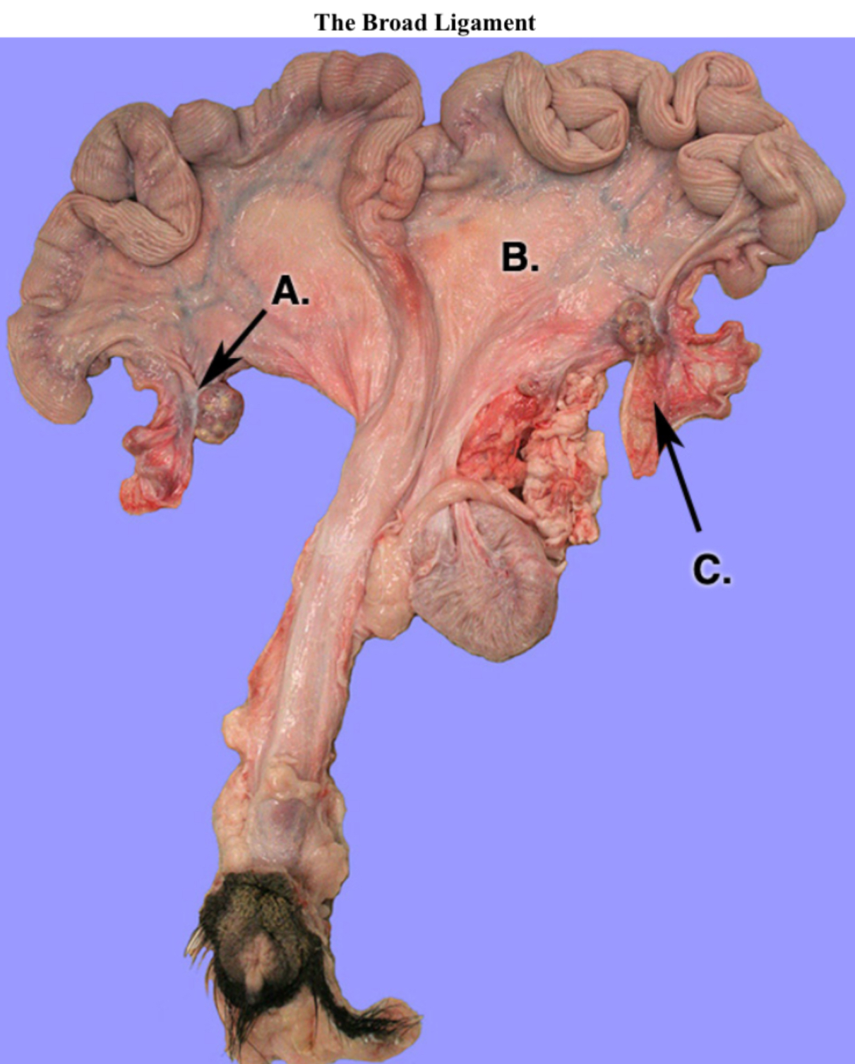 term image