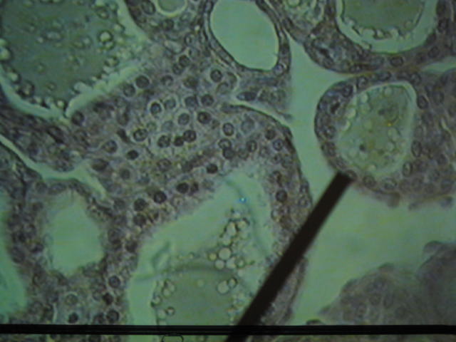 <p>Identify?</p><p>Lab Image 6-13</p>