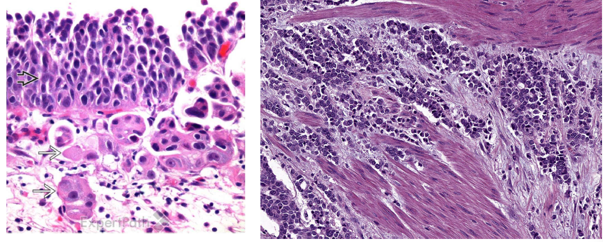 <p>What is this showing histologically?</p>