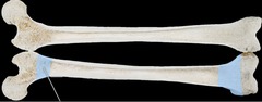 <p>part of diaphysis next to an epiphyseal line</p>