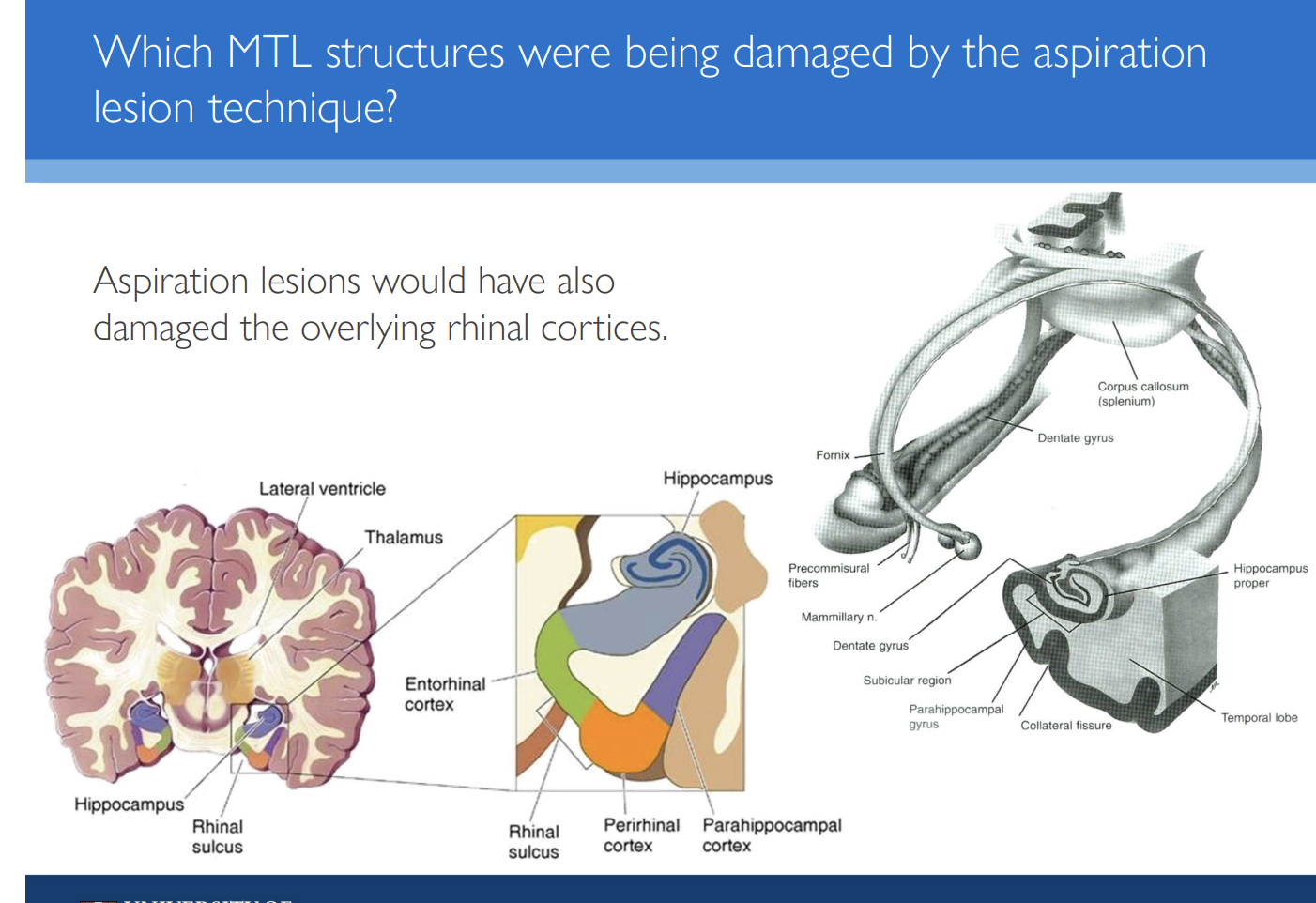 <ol><li><p>damage not consistent from subject to subject → so would even out across data</p></li><li><p>removal of hippocampus and amygdala were required to produce memory impairment</p><ul><li><p>any damage to anything else could be contributing to the <strong>memory impairment</strong></p></li></ul></li></ol><p></p>