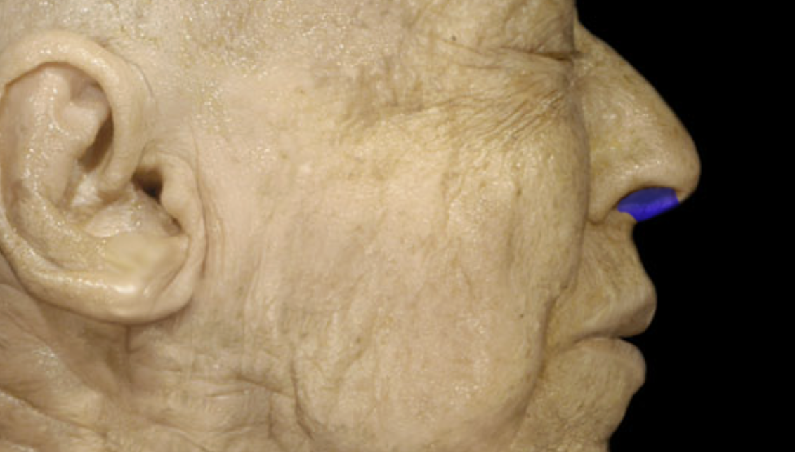<p>Nasal septum </p>