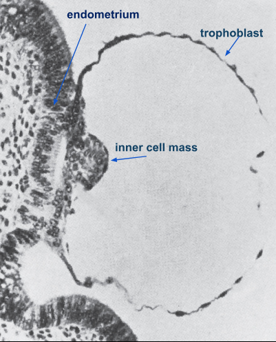 <p>clusters at one end of the blastocyte and will later become the embryo</p>