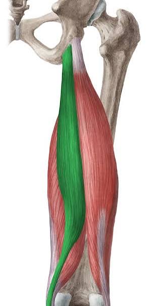 <p>Semitendinosus</p>