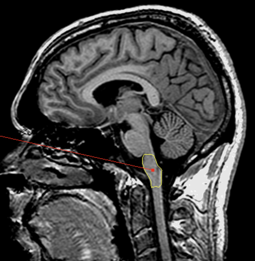 <p>What is the area highlighted called?</p>