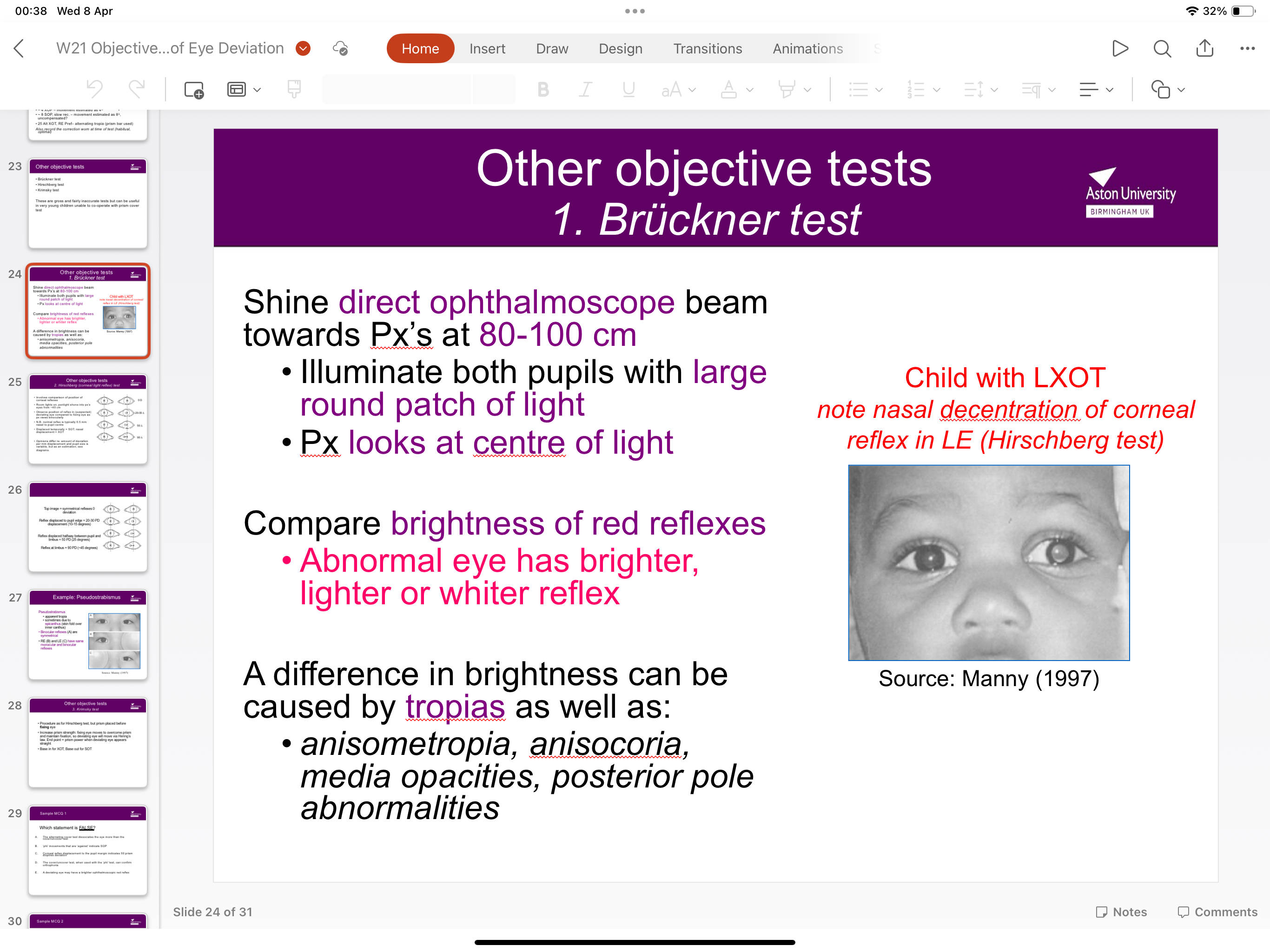 <ul><li><p>Shine direct ophthalmoscope 80-100cm from px eye</p></li><li><p>Illuminate both pupils with large patch of light as px focuses on centre of light</p></li><li><p>Compare brightness of red reflex- abnormal eye is brighter, lighter, or whiter</p></li></ul><p></p>