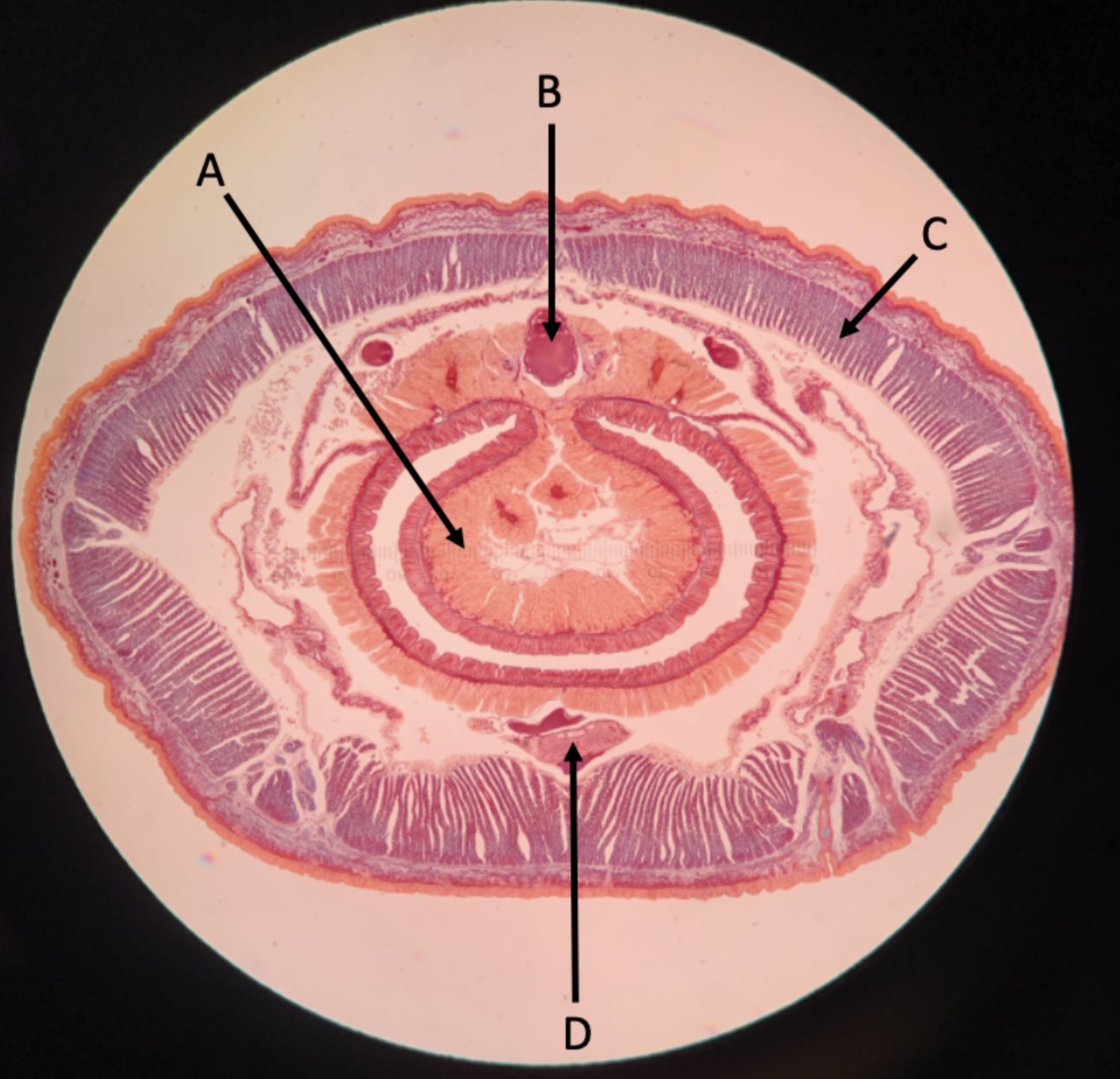 <p>Identify structure C</p>