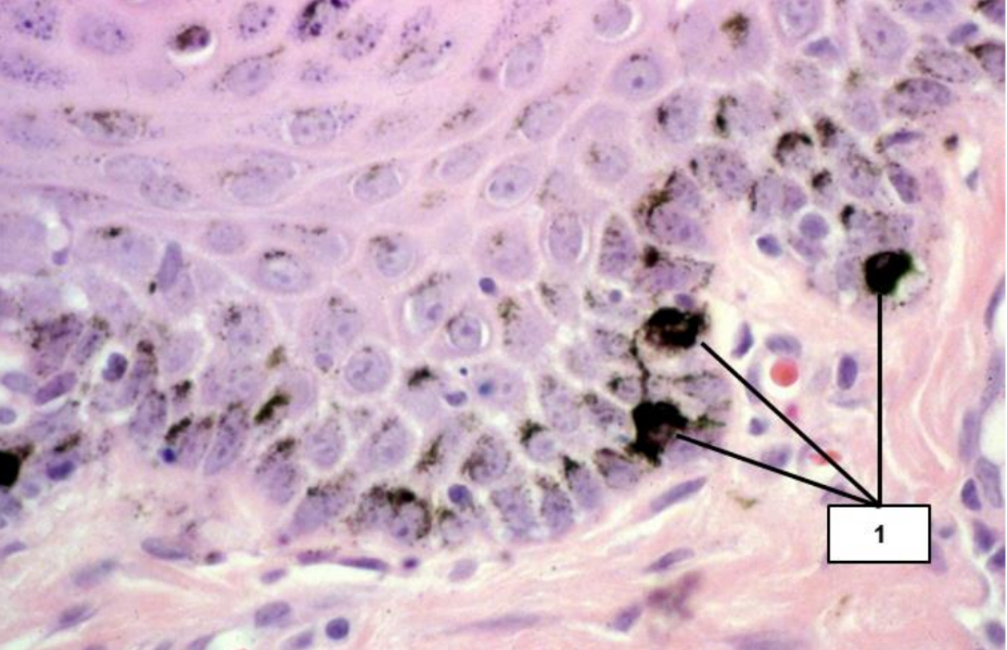 <p>Name the cell type indicated by #1.</p>