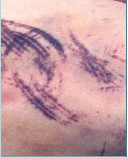 <p>Mention the type of child abuse?</p>