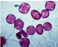 <p>what type of pollen? </p>