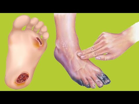 <ol><li><p><span style="color: rgb(240, 68, 68);"><strong>NO wearing sandals</strong></span></p></li><li><p><span style="color: rgb(240, 68, 68);"><strong>NO being barefoot</strong></span> outside</p></li><li><p>Wear <span style="color: rgb(196, 100, 245);">shoes with <strong>socks</strong></span></p></li><li><p><span style="color: rgb(55, 191, 200);">clean any cut w/ warm water, mild soap</span> &amp; dry dressing</p></li><li><p>examine <span style="color: rgb(178, 155, 19);">child’s <strong>eye </strong>yearly</span></p></li><li><p>regular <span style="color: rgb(25, 11, 198);"><strong>dental </strong></span>care</p></li></ol><p></p>