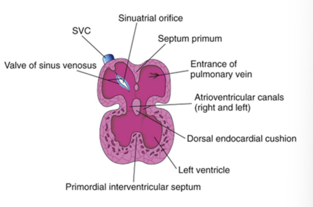 <ol><li><p>Atrioventricular endocardial cushions form on the dorsal and ventral walls of the AV canal from a specialized extracellular matrix related to the myocardium (cardiac jelly) and neural crest cells.</p></li><li><p>Cushions approach each other and fuse, dividing the AV canal into right and left AV canals. </p></li><li><p>Partially separates the primordial atrium from the primordial ventricle to function as primitive AV valves.</p></li></ol><p></p>